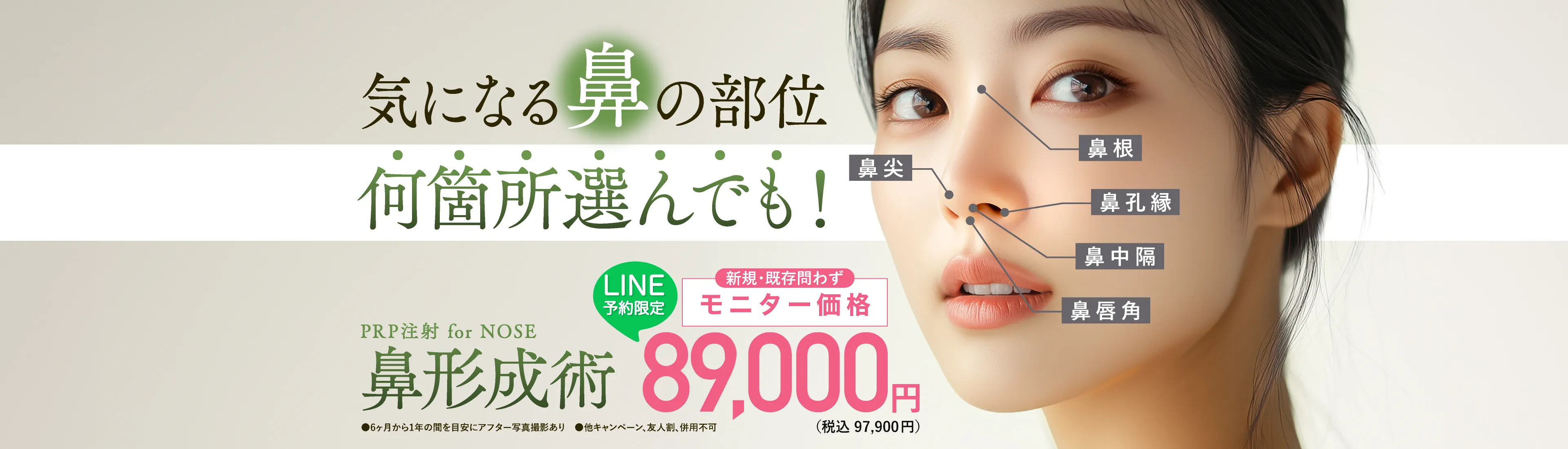 皮ふの立体形成で、鼻を自由自在にデザインする！　PRP注射による鼻形成術