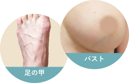 足の甲・バスト