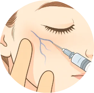 当院のフェイススクレロセラピー