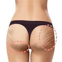 肉割れ・くすみ