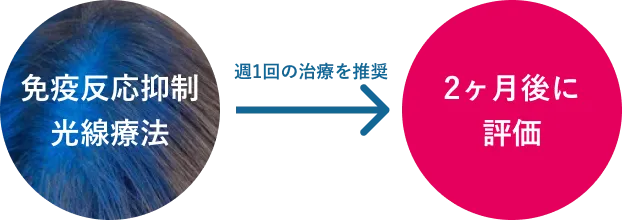 基本のモデルプラン