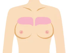 デコルテのごつごつ感を無くしたい