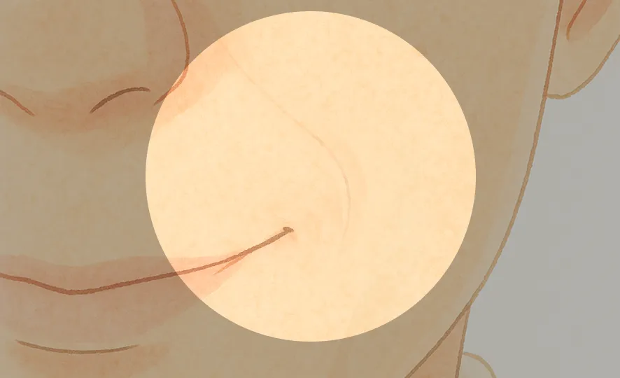 ほうれい線改善 After