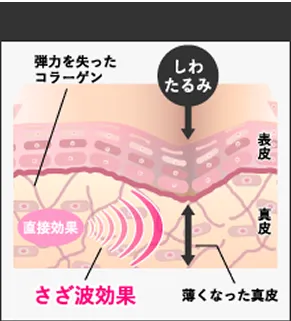 「さざ波」現象による、お顔全体への美肌波及効果