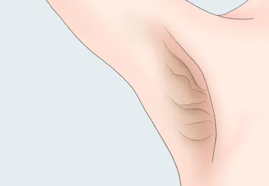 シワ・たるみの原因