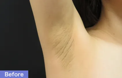 深いシワがあり、全体的に黒ずんでいる状態