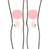 膝上（両側）の施術イメージ