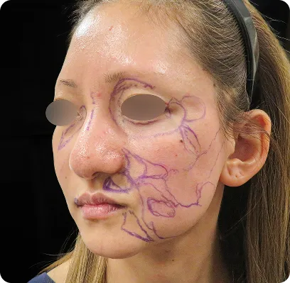 Point1のデザイン後の女性の顔