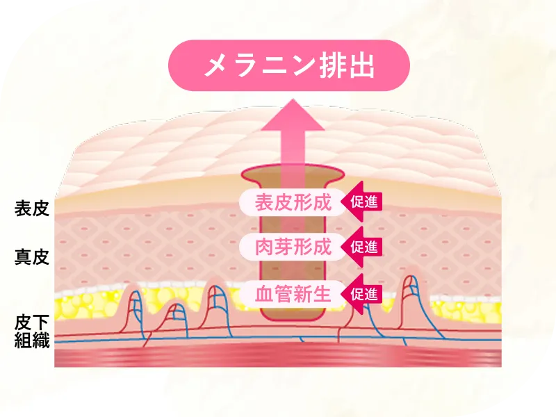 血流を取り戻し色素沈着軽減