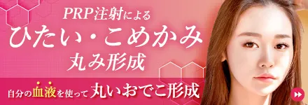 PRP注射によるひたい・こめかみ丸み形成