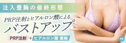 PRP注射とヒアルロン酸によるバストアップ