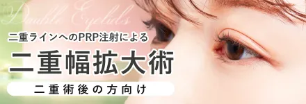 二重ラインへのPRP注射による二重幅拡大術
