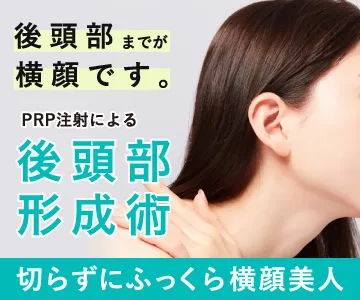 後頭部までが横顔です。PRP注射による後頭部形成術