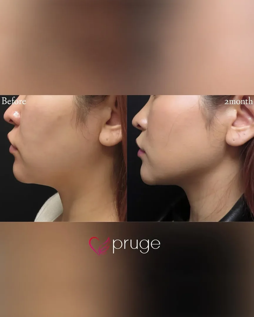 塩見 知大院長 代表症例4