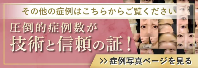 その他の症例はこちらからご覧ください　圧倒的症例数が技術と信頼の証！　症例写真ページを見る