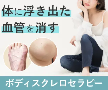 体に浮き出た血管を消す　ボディスクレロセラピー